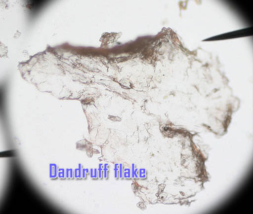 Dandruff flake under microscope