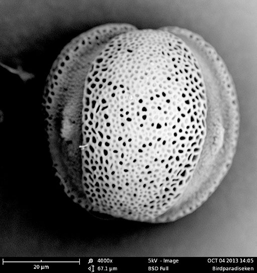 Bird of Paradise Pollen Micrograph