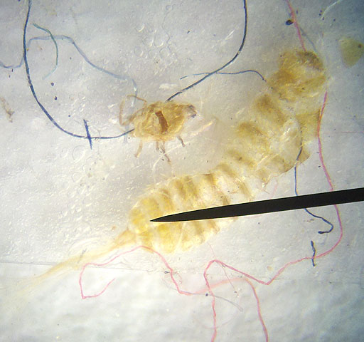 Insect and fibers under scope